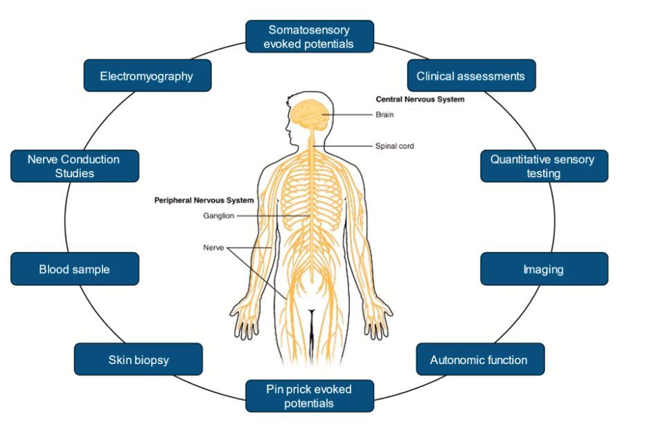 MSKPhysioJnl's tweet photo. 📕 #Neuroimmune Special Issue Series - 🟢 OPEN ACCESS - https://t.co/EES20xGbQR - Are we fully assessing nerve pathology when managing persistent musculoskeletal pain? #NerveAssessment #PersistentPain #NeuroRehab #ClinicalExamination https://t.co/bgNjJImWTy