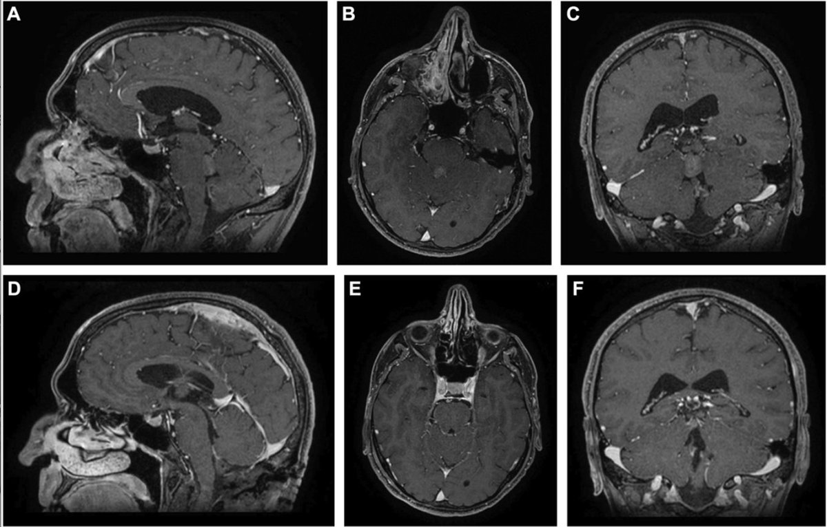Neurosurgery Publications tweet media