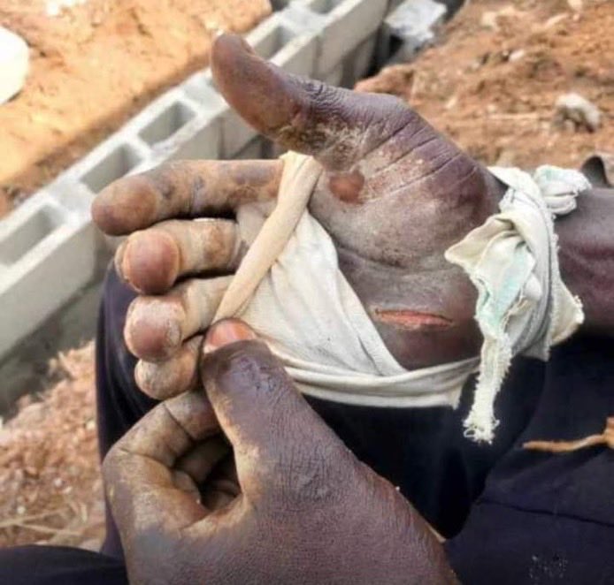 Have missed engaging my mutuals 😢
Drop a comment, like and I’m engaging you till my hands turn like this today.