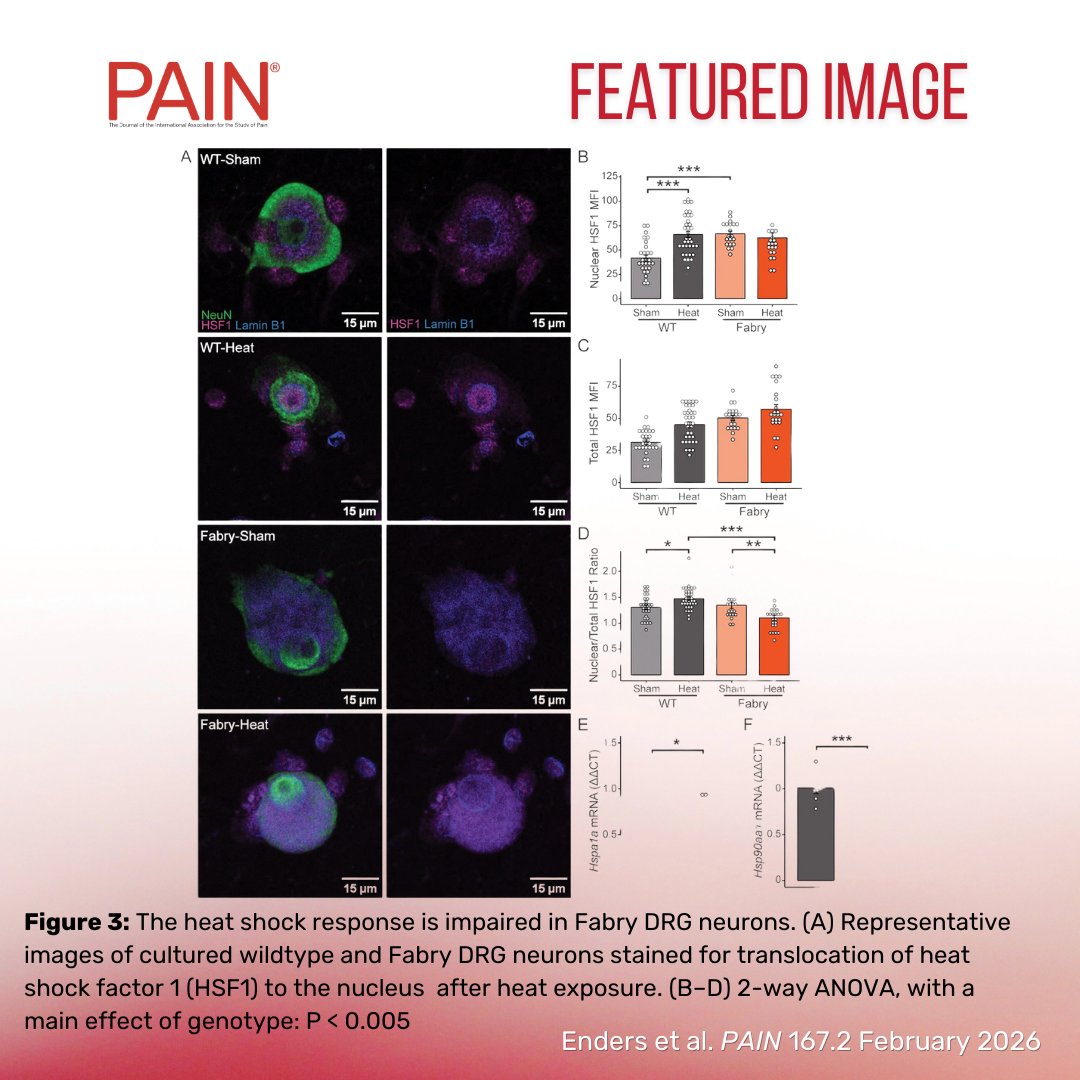 PAIN Journal tweet media
