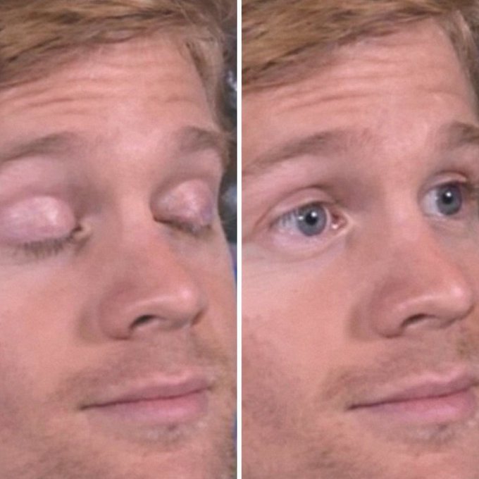 🇺🇸 Drew Scanlon, devenu célèbre en 2013 grâce à un mème viral, utilise sa notoriété pour soutenir des actions solidaires. 

Depuis 2016, il participe chaque année à la course Bike MS afin de récolter des fonds pour la National Multiple Sclerosis Society. 

Grâce à ses