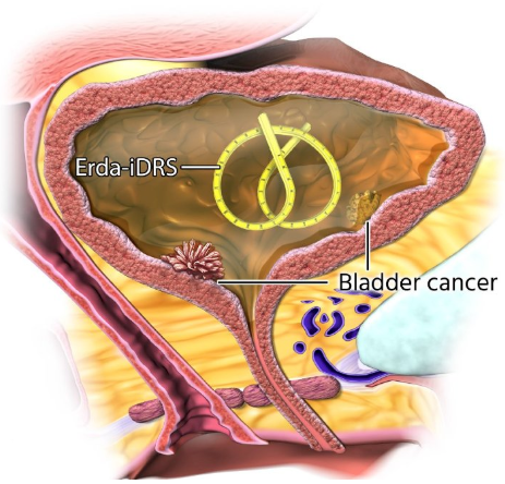 UroToday.com tweet media