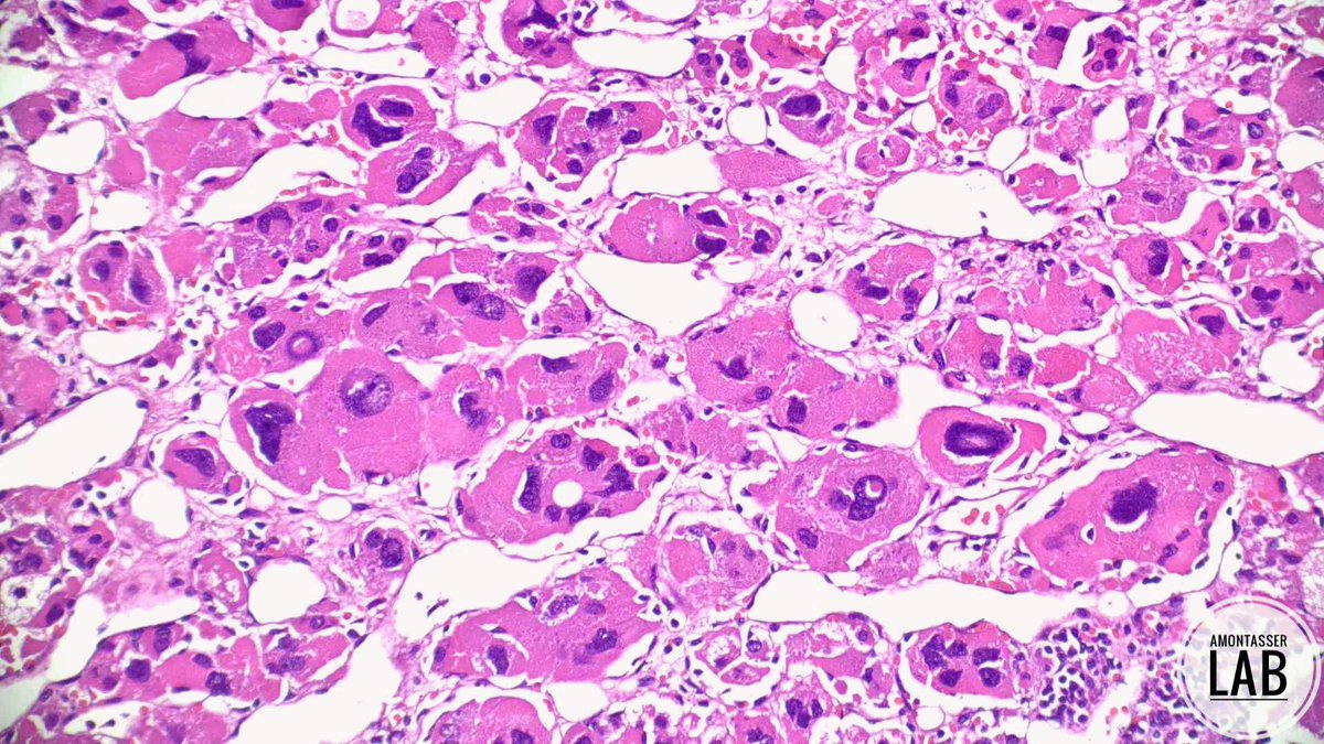 Ahmed Montasser tweet media