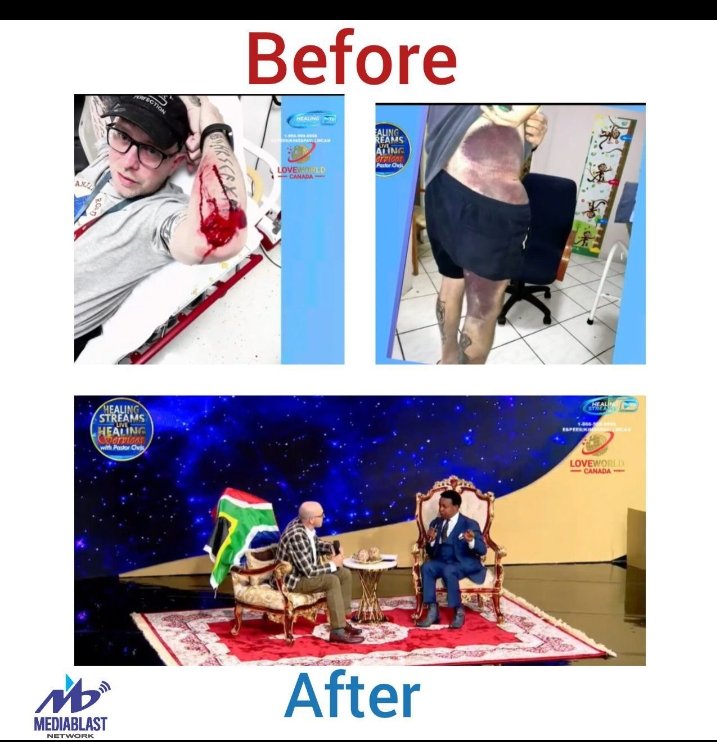Before and After of a live testifier of the Healing Streams with Pastor Chris