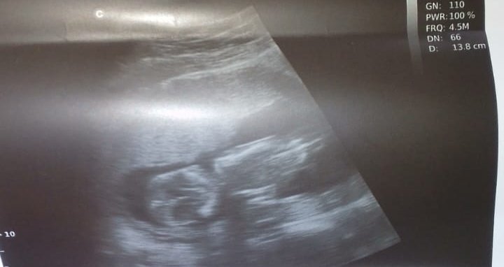 pekey95's tweet photo. @thenihiin Get someone preg https://t.co/mvsTEzm2yU