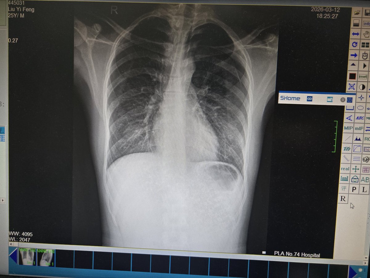 刘品品isaL77 tweet media