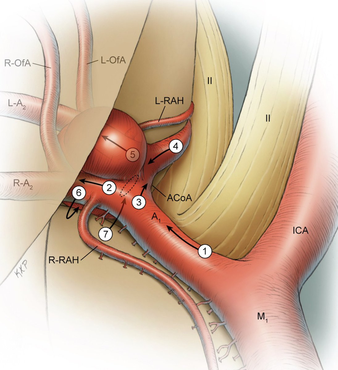 Michael T. Lawton, MD tweet media