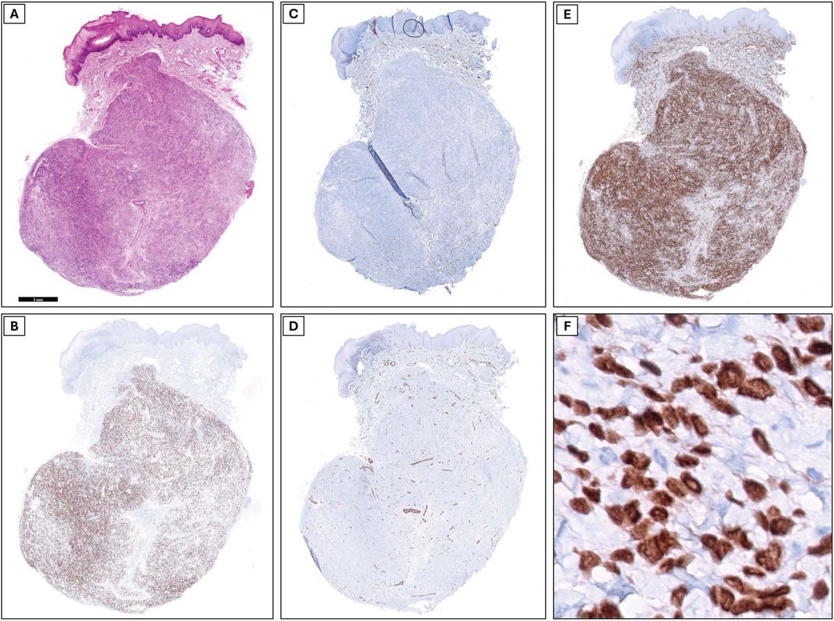 American Journal of Dermatopathology tweet media