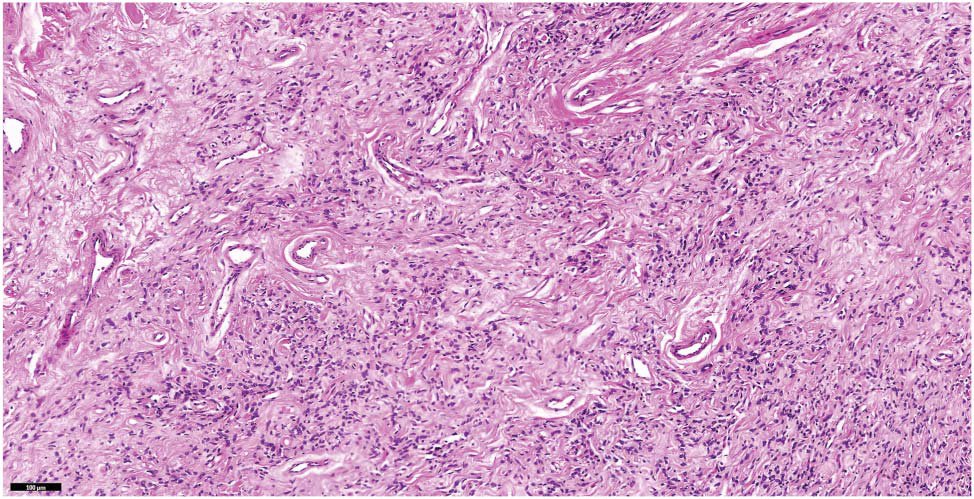 American Journal of Dermatopathology tweet media