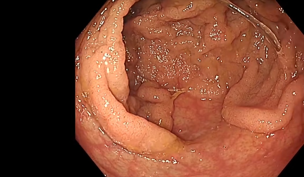 VideoGIE Journal tweet media