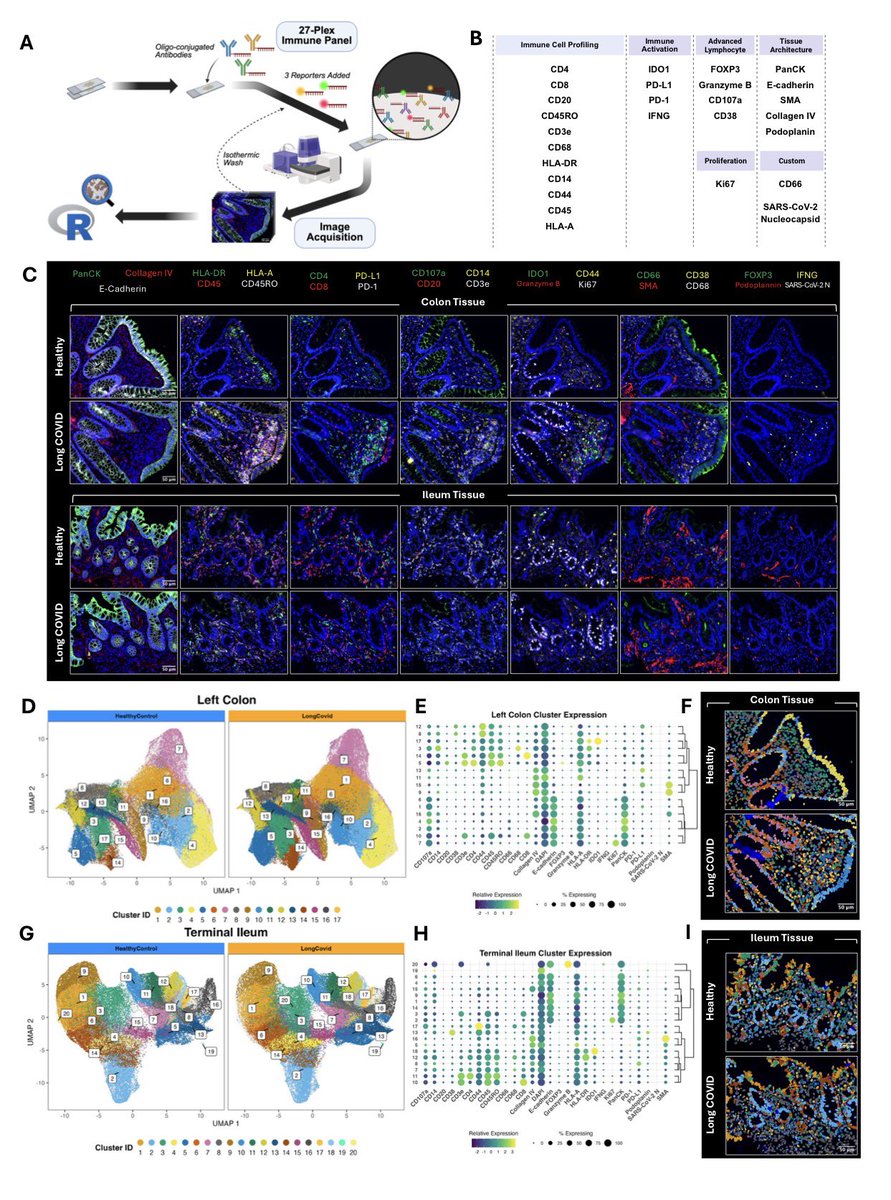 vipintukur's tweet photo. Take-home message:

👉 Persistent viral proteins in the gut may contribute to long-term immune dysregulation in Long COVID, helping explain ongoing symptoms. 5/5

https://t.co/KNLK8Zvlm5 https://t.co/efaN0QlTmO