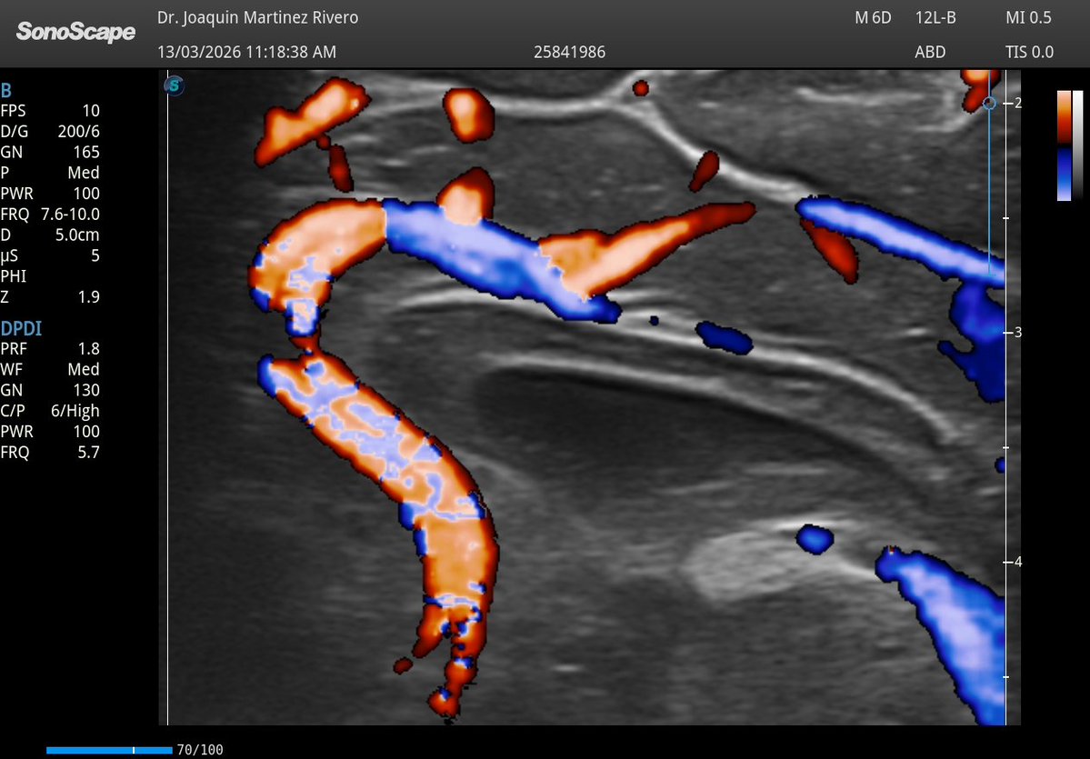 Joaquín Martínez tweet media