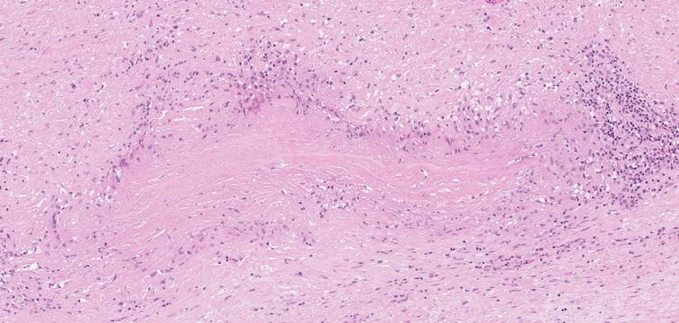 Cardiac Path Network tweet media
