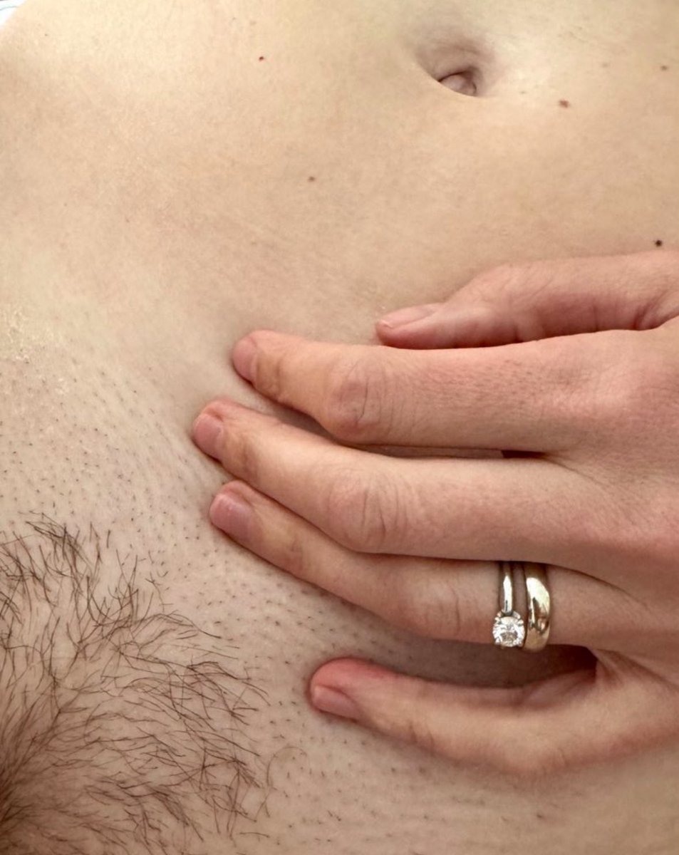 Shameless Couple tweet media