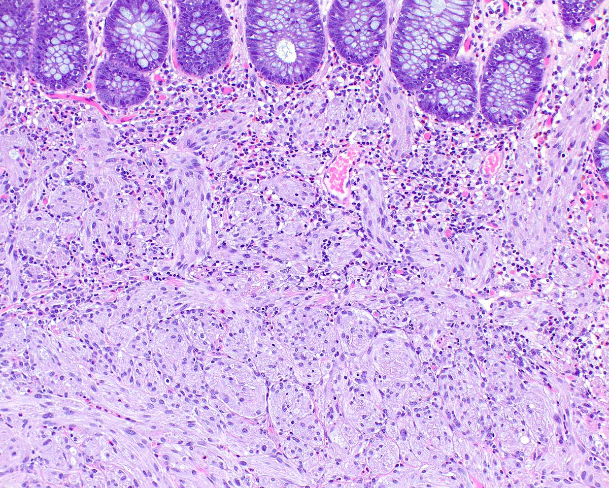 UMiami Pathology tweet media