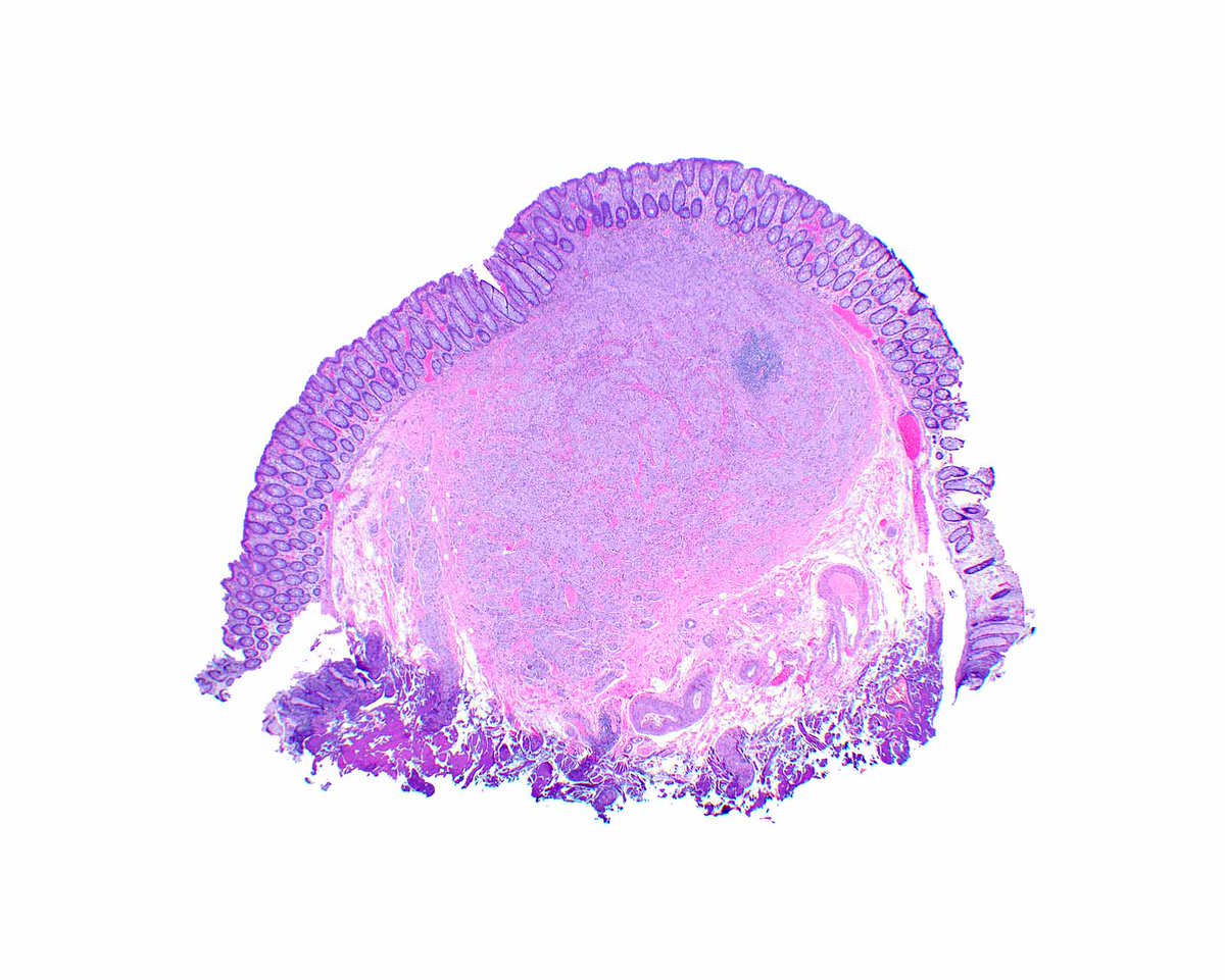UMiami Pathology tweet media