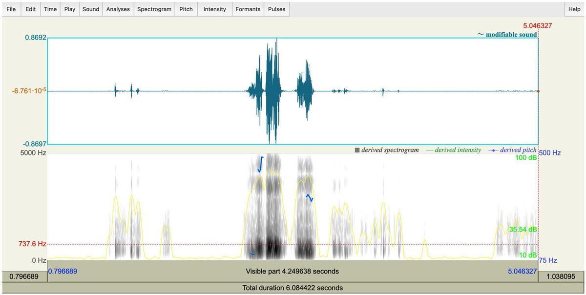 Logopedics Phoniatrics Vocology tweet media