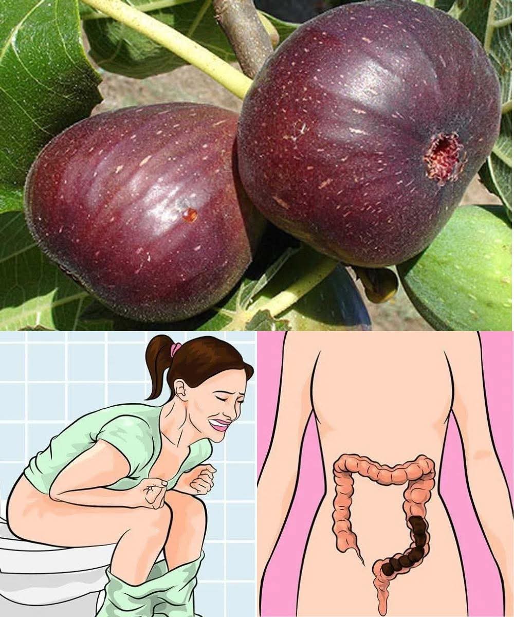 7 Natural Remedies to Beat Constipation Fast — And Why Figs Are the Underrated Hero 🍯👇
Constipation hits harder than people admit—bloating, straining, that “blocked” discomfort nobody wants to talk about. Nature has answers, and one of the most slept-on remedies? Figs. Let’s