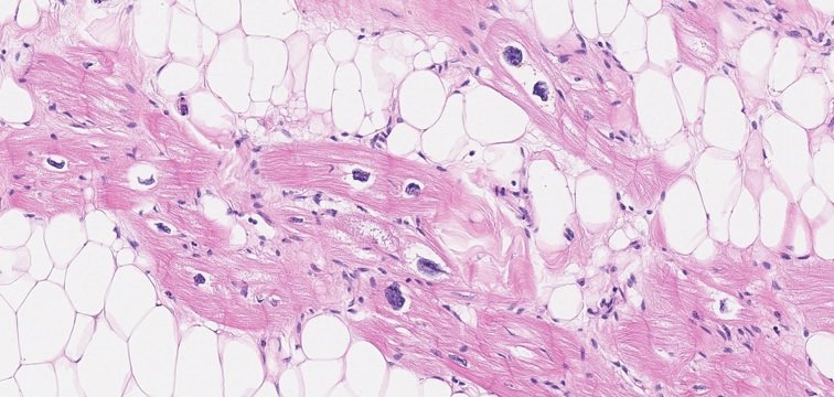 Cardiac Path Network tweet media