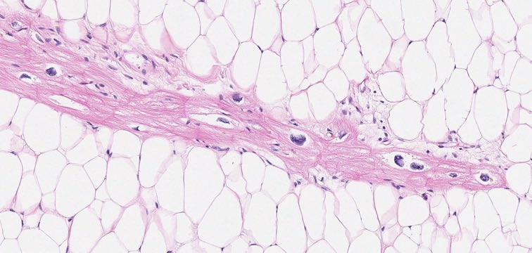 Cardiac Path Network tweet media