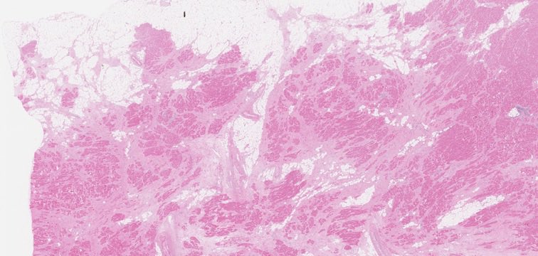 Cardiac Path Network tweet media