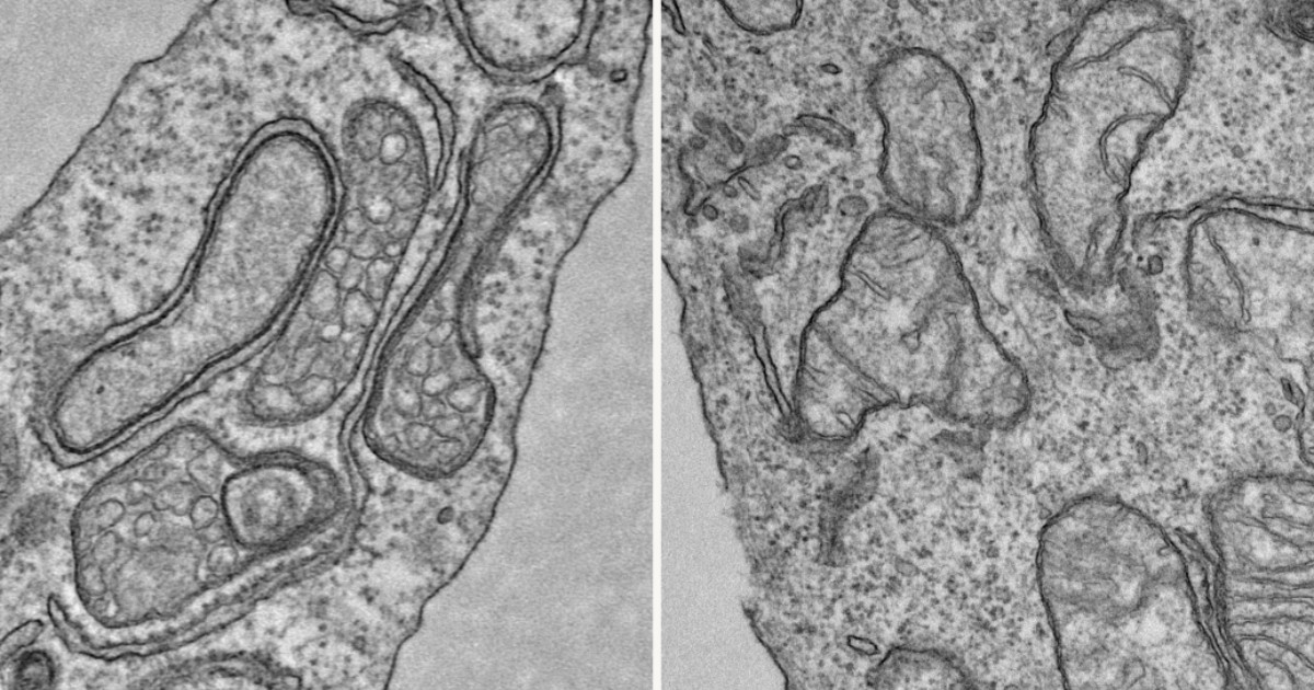 U-M Rogel Cancer Center tweet media