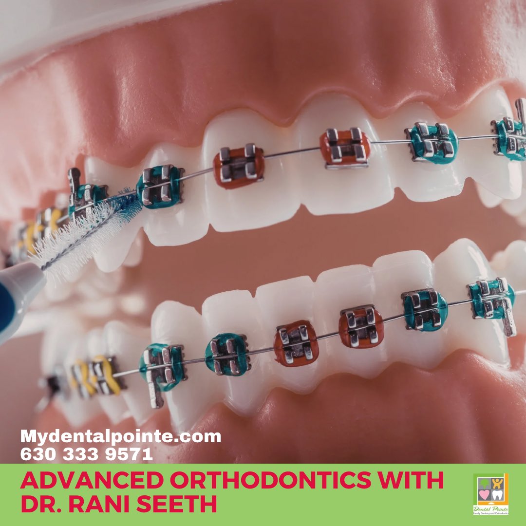 Schedule your advanced orthodontic treatment with the highly experienced Dr. Rani Seeth. Call today for setting up a free consultation. #dentalpointe #napervilledentist #auroradentist #warrenvilledentist #familydentist