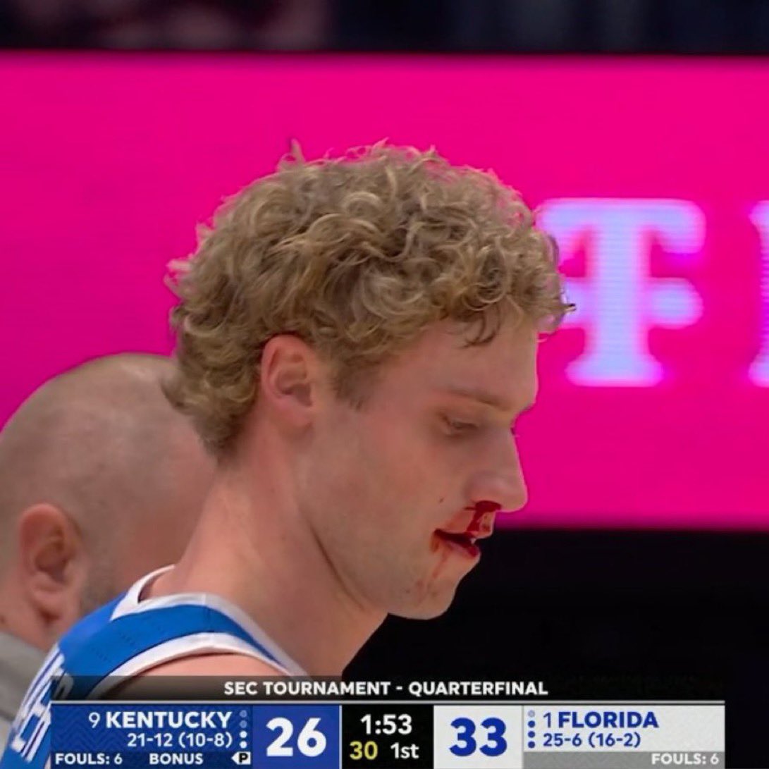 EliteBBN's tweet photo. Foul on Kentucky btw https://t.co/AXBXw9SyFl