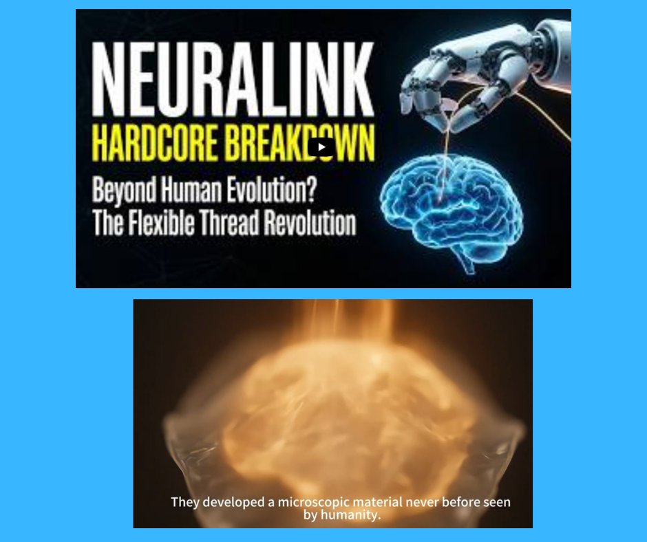 SPINALpedia's tweet image. "Why has the Brain-Computer Interface been stuck for 30 years? We explore the fatal flaw of the Utah Array; the rigid spikes that act like daggers inside the brain &amp;amp; how Neuralink’s "Flexible Threads" finally broke the seal."

spinalpedia.com/community/vide…

#neuralink #spinalcordinjury