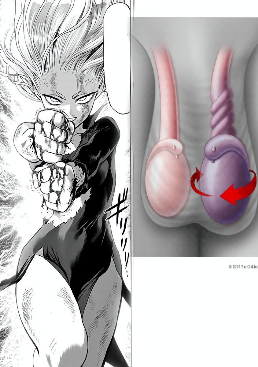 Tatsumaki attacks you at 3am

How'd you react?