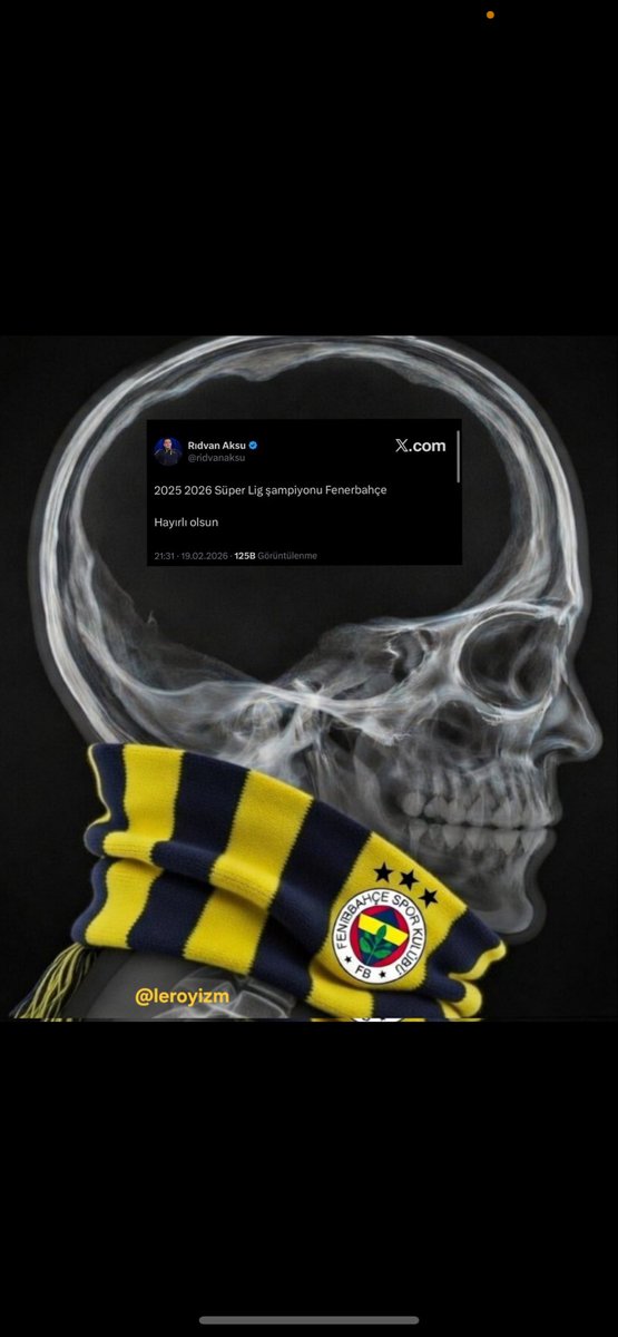 Ceksparow5's tweet photo. 😂😂😂 #KGvFB https://t.co/o6WrU3yV07