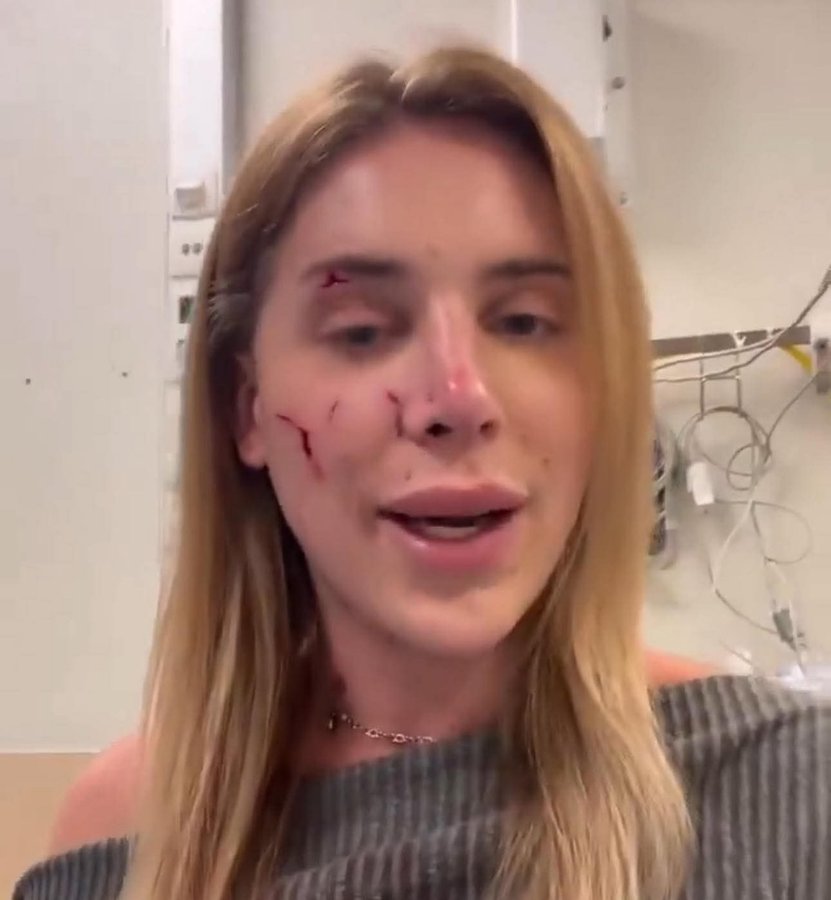 Trans influencer beaten in Brussels by Islamist asks:

I supported Palestine. I don’t understand why they attacked me?