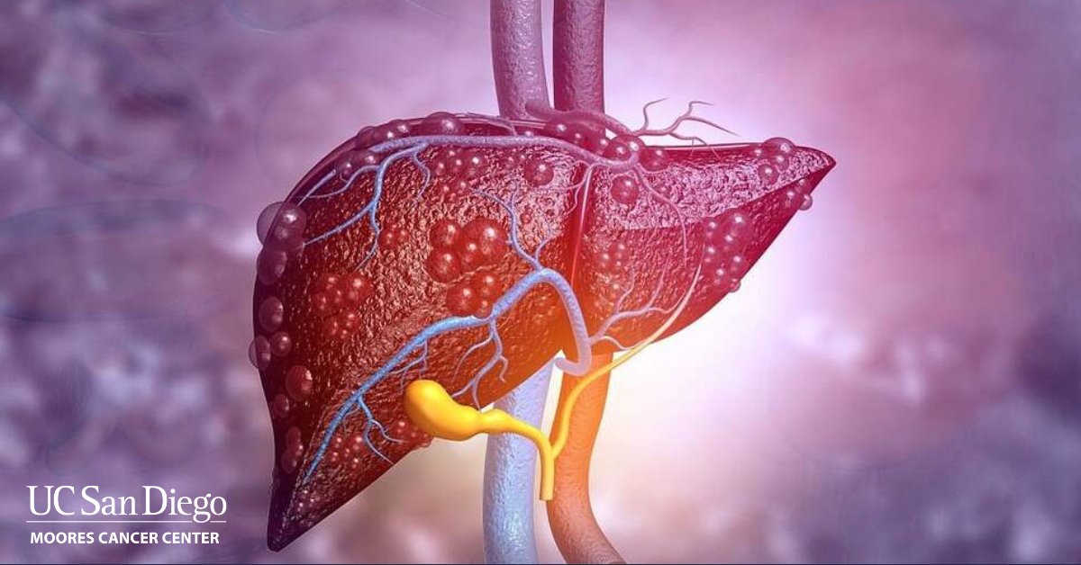 UC San Diego Health Moores Cancer Center tweet media