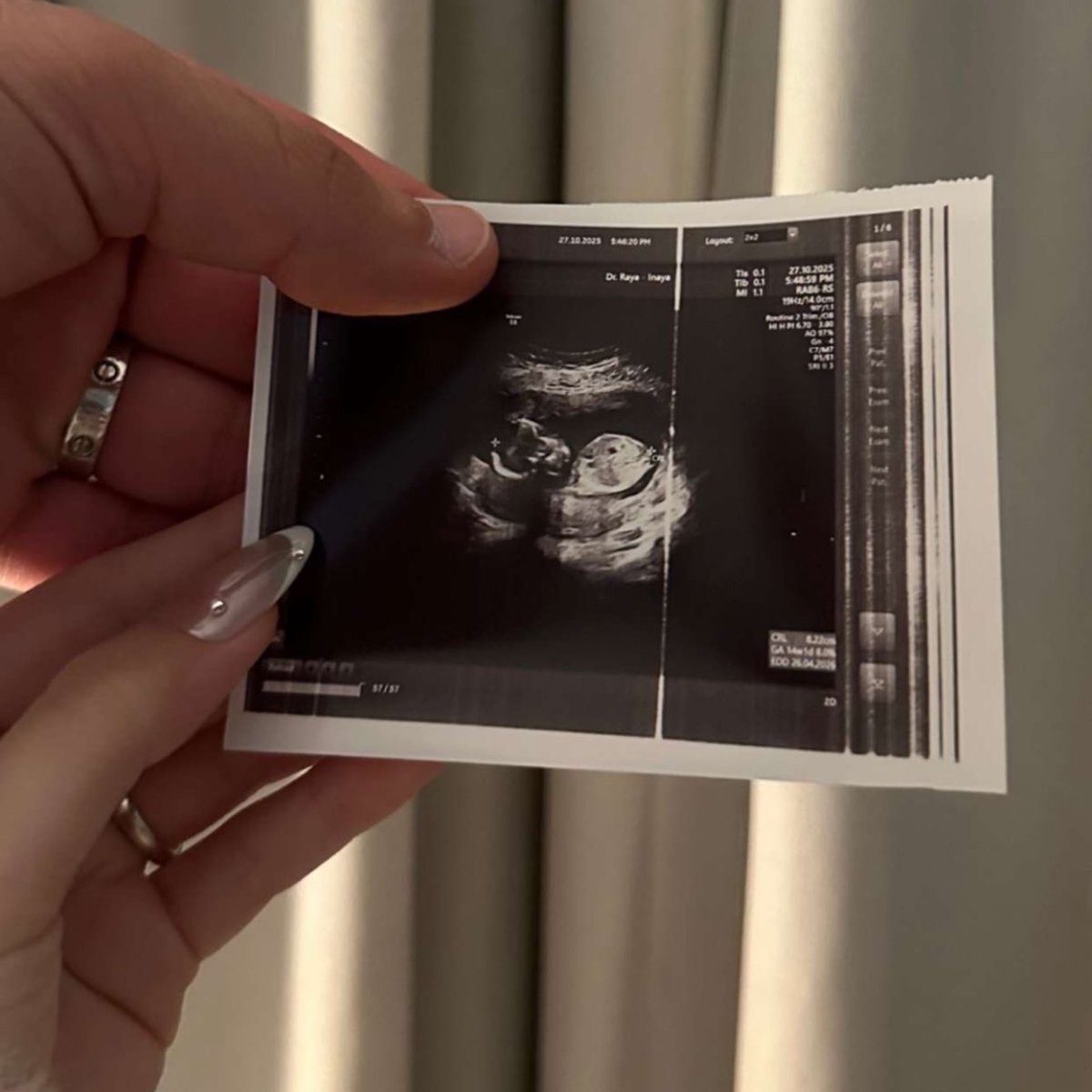 لحظة tweet media