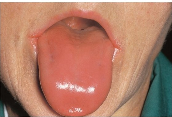 احمد tweet media