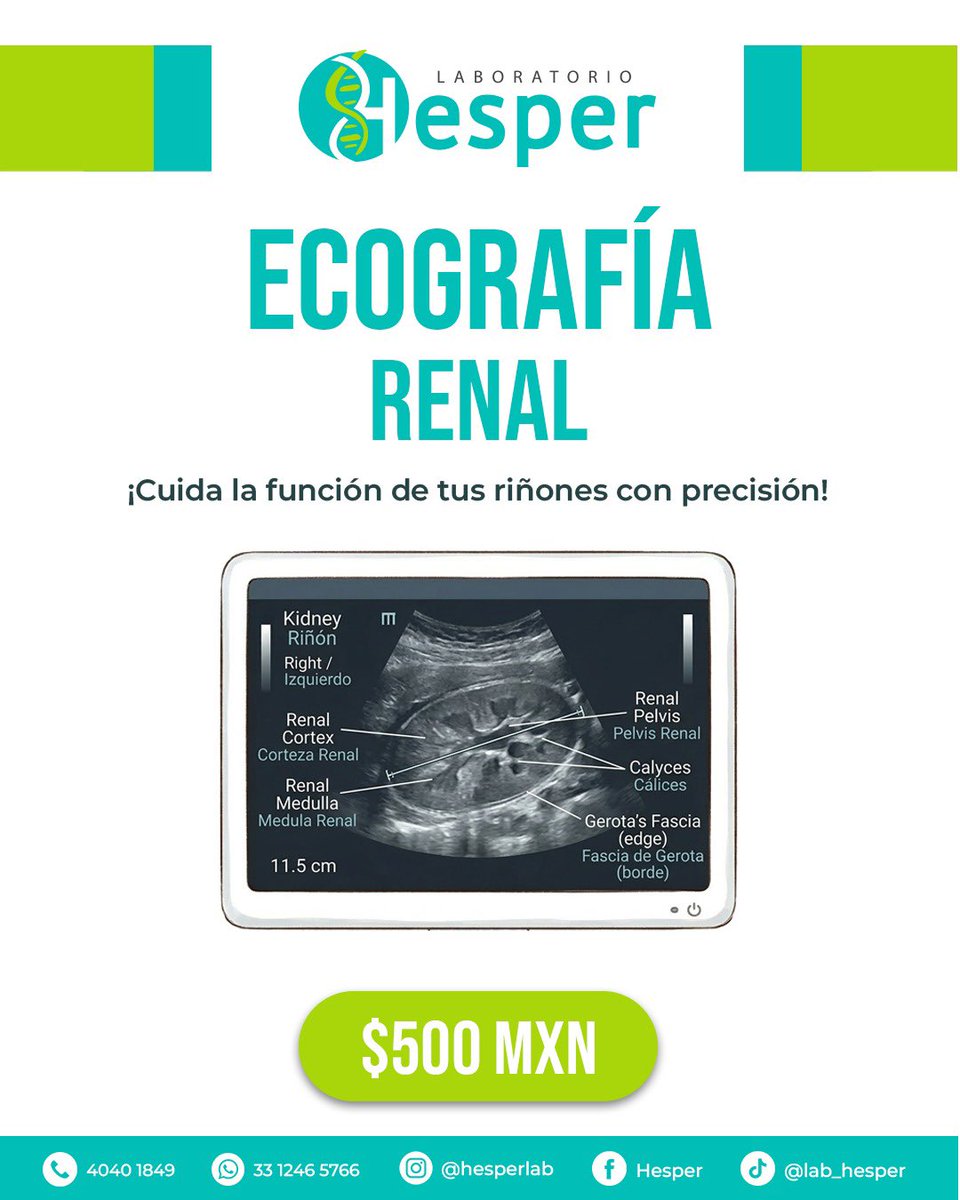 Hesperlab's tweet photo. 💙 𝐄𝐜𝐨𝐠𝐫𝐚𝐟𝐢́𝐚𝐬 𝐩𝐚𝐫𝐚 𝐭𝐮 𝐬𝐚𝐥𝐮𝐝 💙
Conoce cada uno de los tipos que tenemos y sus costos.

𝐄𝐧 𝐋𝐚𝐛𝐨𝐫𝐚𝐭𝐨𝐫𝐢𝐨 𝐇𝐞𝐬𝐩𝐞𝐫 𝐭𝐞 𝐨𝐟𝐫𝐞𝐜𝐞𝐦𝐨𝐬 𝐜𝐨𝐧𝐟𝐢𝐚𝐧𝐳𝐚 𝐲 𝐩𝐫𝐞𝐜𝐢𝐬𝐢𝐨́𝐧 𝐞𝐧 𝐜𝐚𝐝𝐚 𝐞𝐬𝐭𝐮𝐝𝐢𝐨 🔬✨
✅ Cuida tu salud https://t.co/fk8MbSVZpS