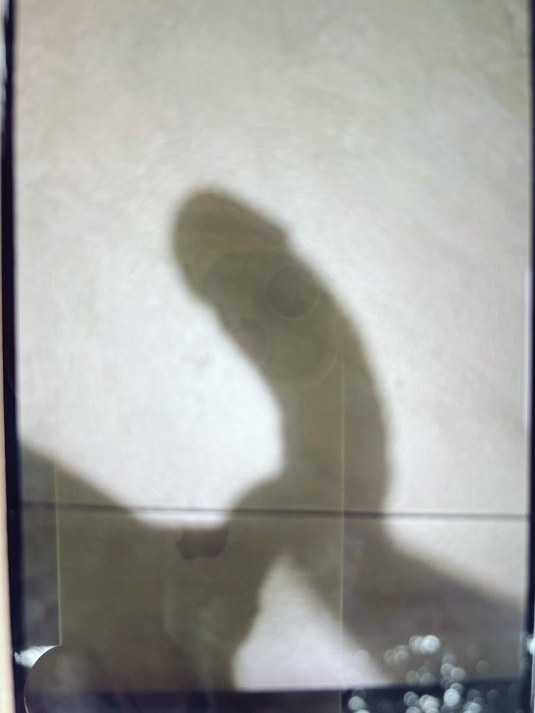 sorrisoblack01's tweet photo. Precisei fazer uma radiografia , cadê os  amigos da área de saude pra me ajudar? https://t.co/tXOWtNogWc
