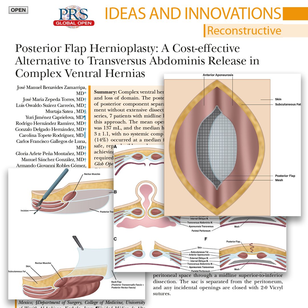 PRS Global Open tweet media