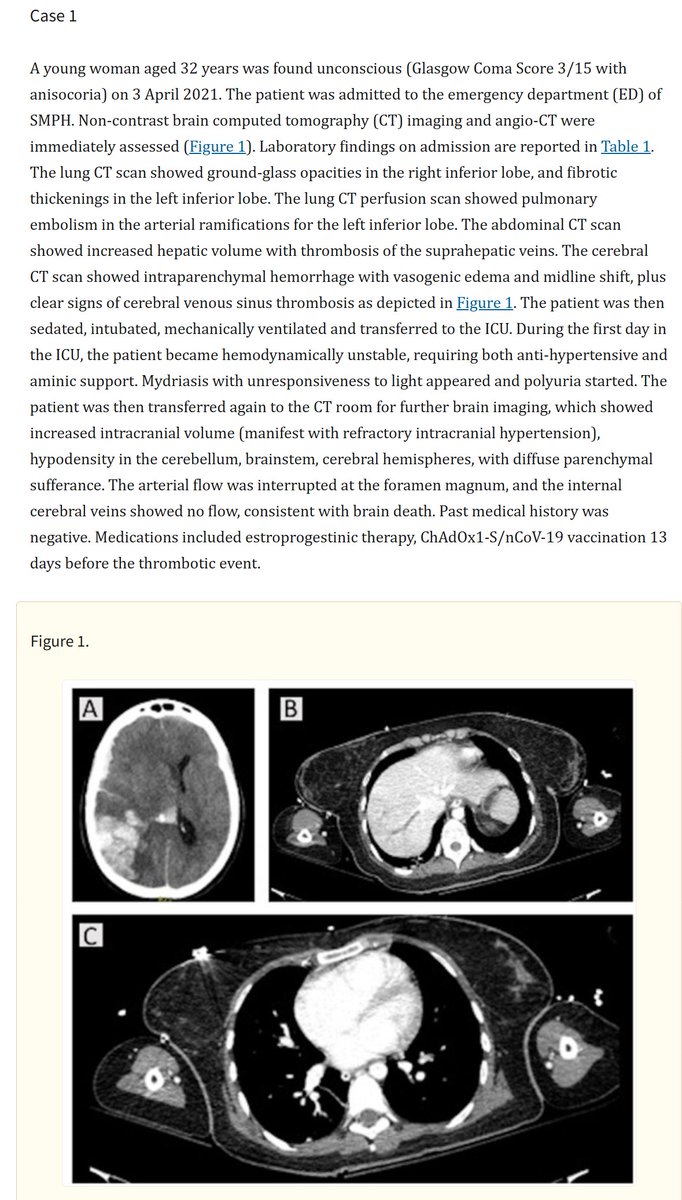 mRNAdeaths's tweet photo. "woman aged 32 years was found unconscious"

"was admitted to the ED"

"scan showed pulmonary embolism"

"sedated, intubated, mechanically ventilated and transferred to ICU"

"internal cerebral veins showed no flow, consistent with brain death

AstraZeneca vaccine 13 days prior⬇️ https://t.co/O6gUcYWAIb