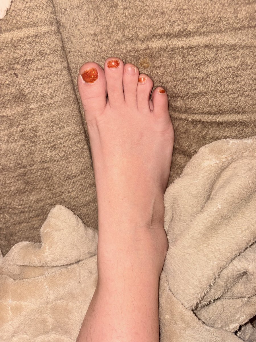 Diamondeyezz97's tweet photo. Who’s next to paying for my pedicure?? #feet #footboy #feetworshi̇p https://t.co/NJ3MnSynxG