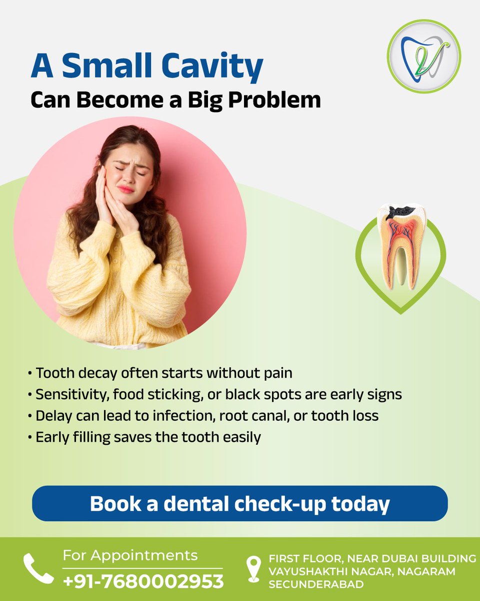 srivatsav_cs's tweet image. Tooth decay often starts without pain. Early signs like sensitivity, food sticking, or black spots should not be ignored. Delaying treatment can lead to infections, root canals, or even tooth loss. Early fillings are the best way to save your tooth.
#Toothdecay #Dentalhealth