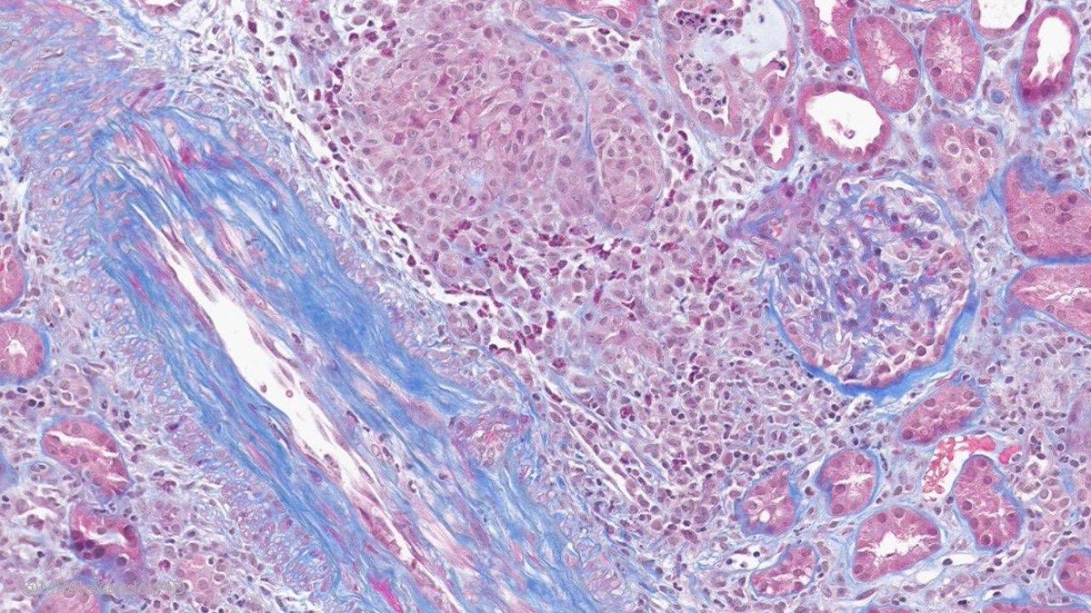 Priya Alexander, MD tweet media