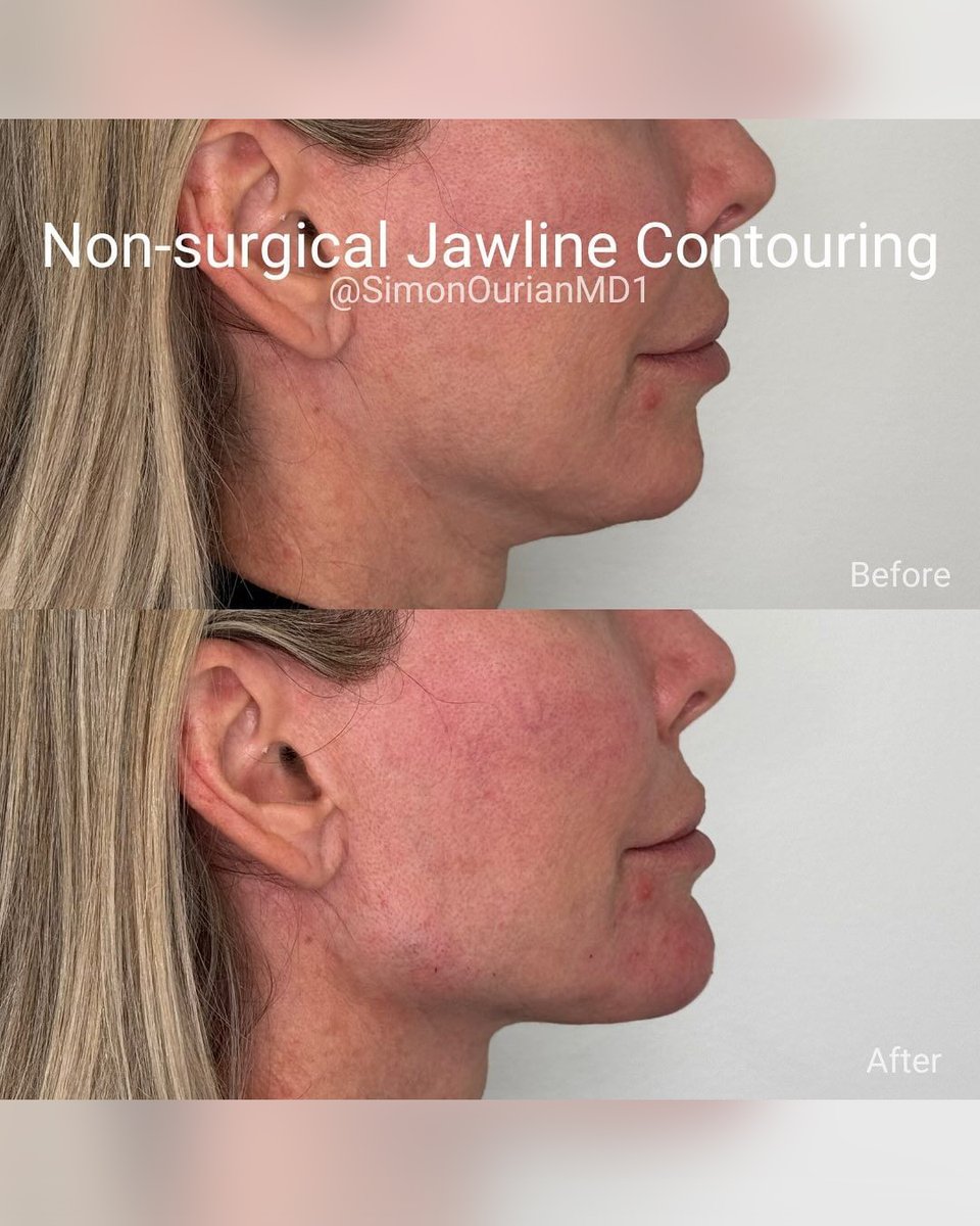 Dr. Simon Ourian - Epione tweet media