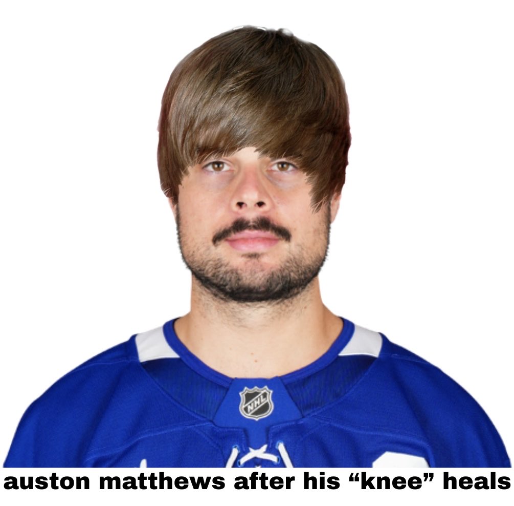 tealmack's tweet photo. I’m starting a rumor auston matthews isn’t actually hurt he is just going to turkey to get a hair transplant and needs time and privacy away from the media to recover from it https://t.co/T33NBhMl8X