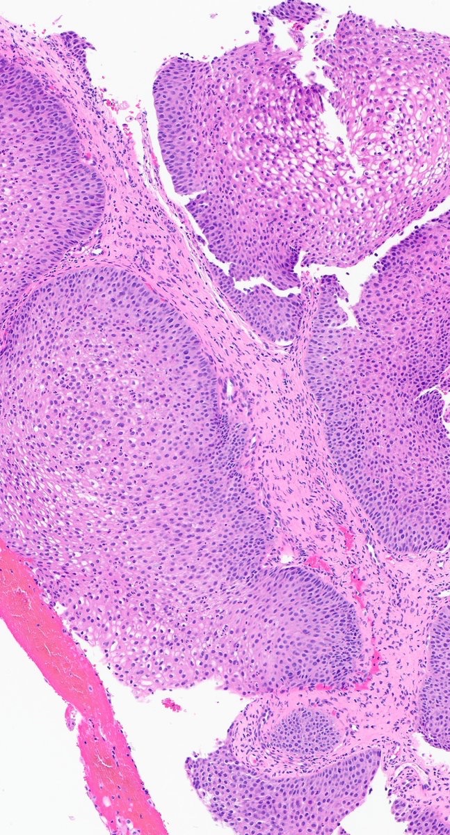 Zemplén Pataki, MD, PhD tweet media