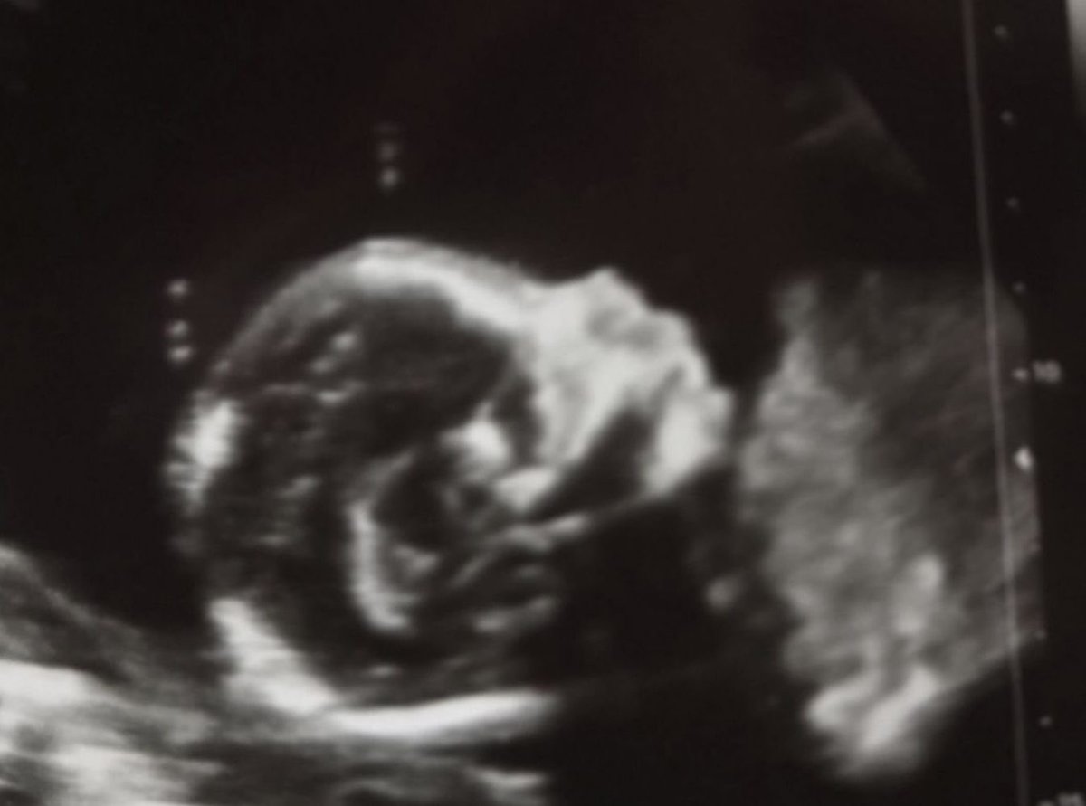 Languagehacker tweet media