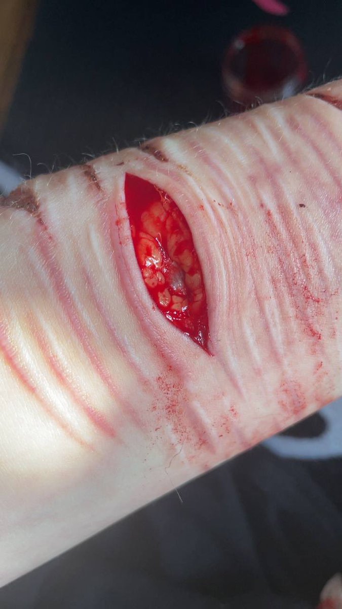 Deprived tweet media