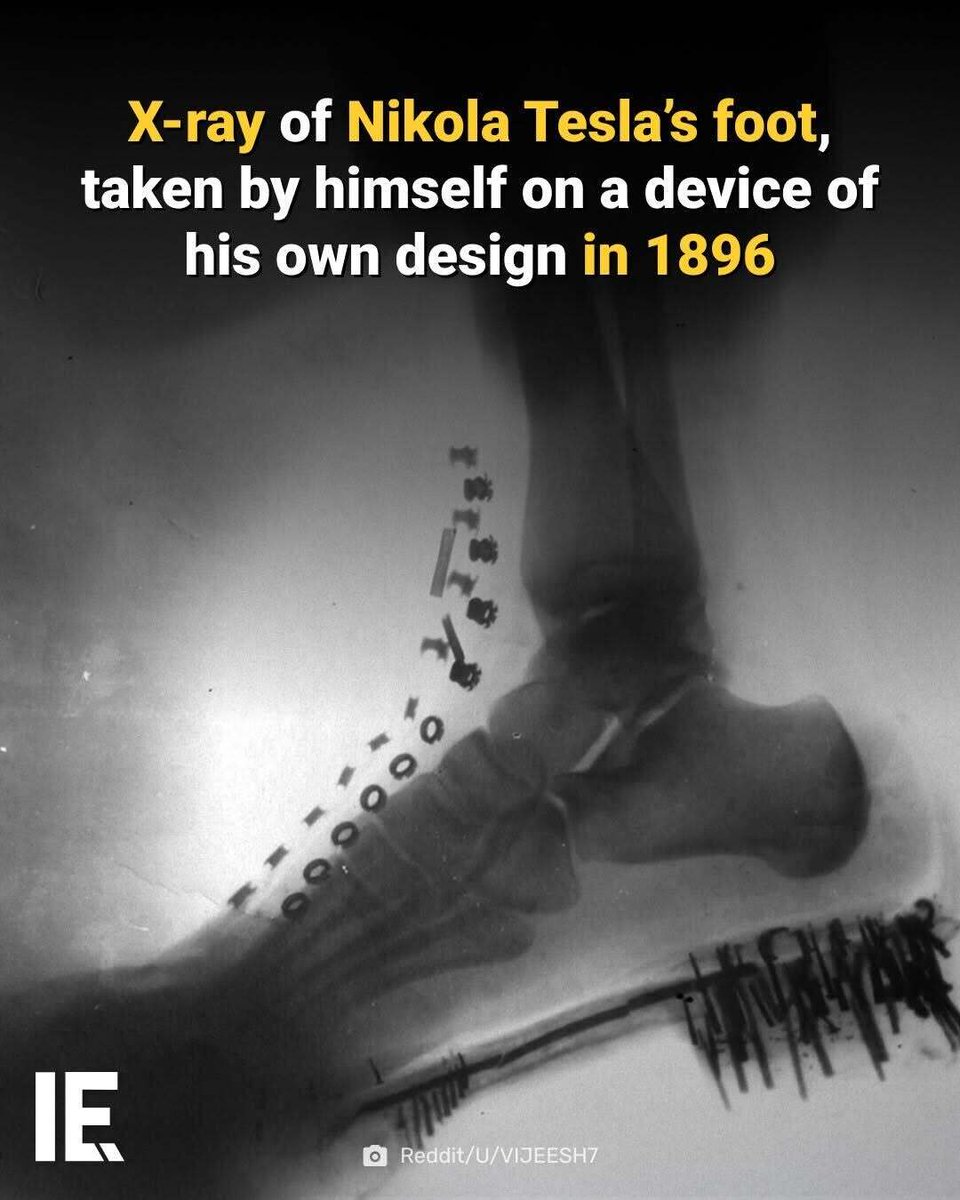 IntEngineering's tweet image. A shadowgraph of a human foot with a shoe on. Tesla made this image in 1896 with X-rays generated by his own vacuum tub, at a distance of 2.5 meters.⁠

For more content like this, tap the link in bio.
⁠
#NikolaTesla #XRay #Shadowgraph #HistoryOfScience