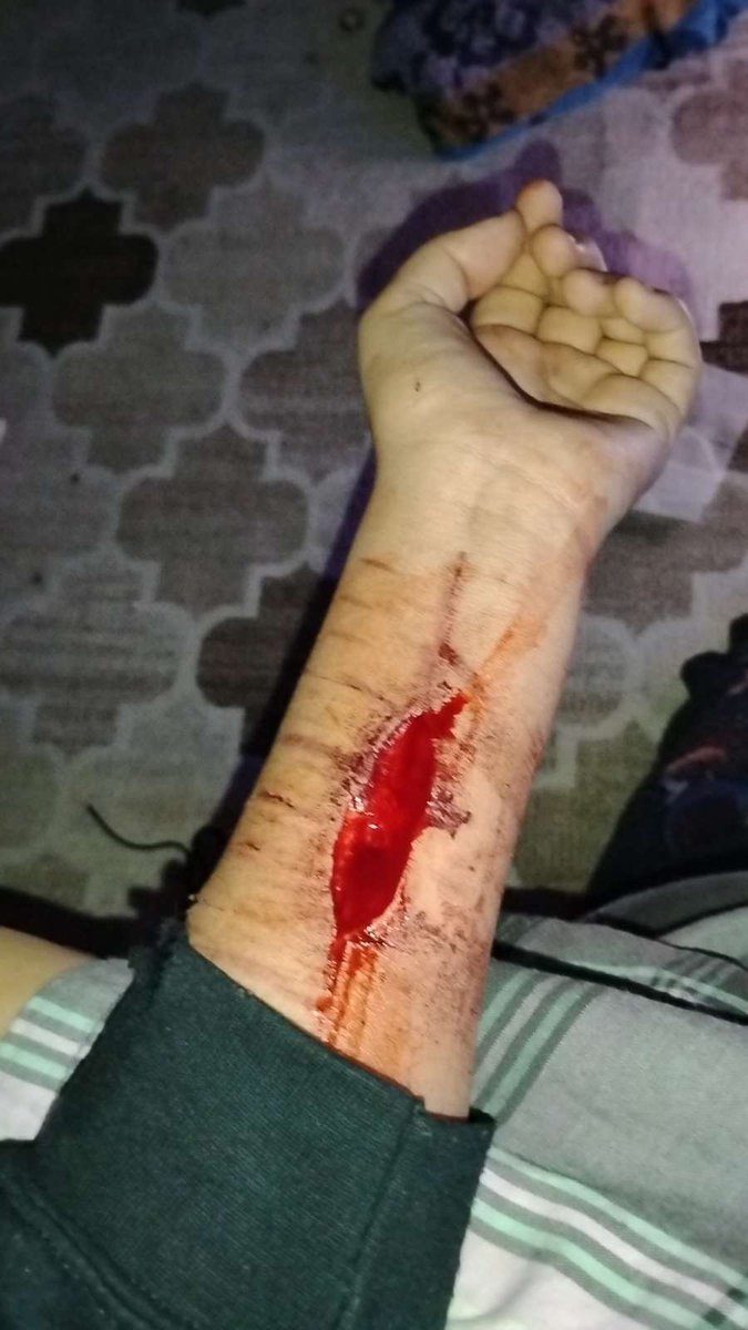 florianx144735's tweet photo. Lwk in the hospital right now cuz of this🥀 https://t.co/bXNZGDf7EF