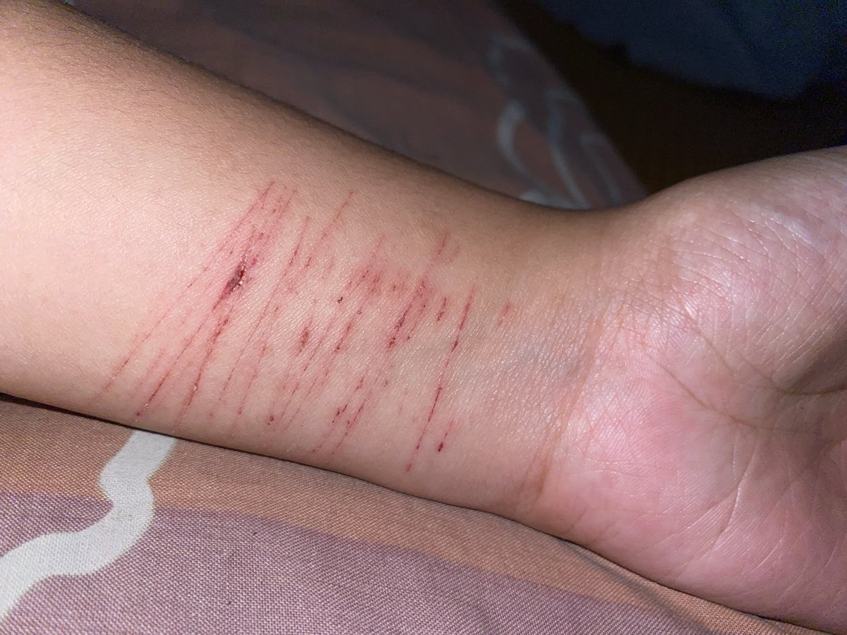 projenpood's tweet photo. after almost 3 years gapernah gini lagi, bisa2nya tangan mulusku kemarin tercoreng lg https://t.co/z9A8zuhm9k
